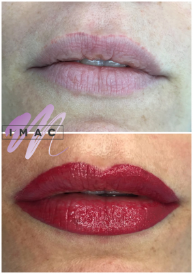Micropigmentaci�n de Labios